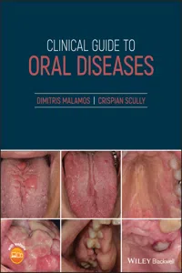 Clinical Guide to Oral Diseases_cover