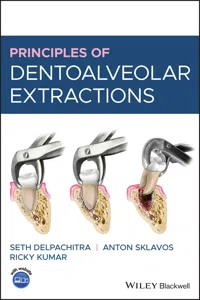 Principles of Dentoalveolar Extractions_cover
