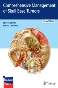 Comprehensive Management of Skull Base Tumors_cover