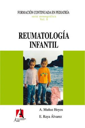 Reumatología infantil