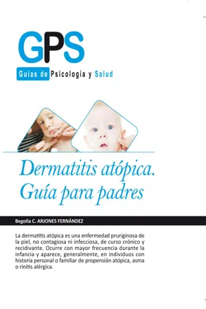 Dermatitis atópica