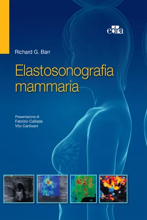 Elastosonografia mammaria