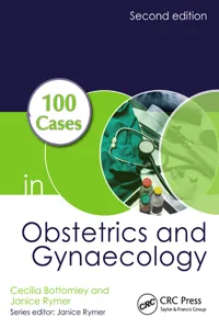 100 Cases in Obstetrics and Gynaecology_cover