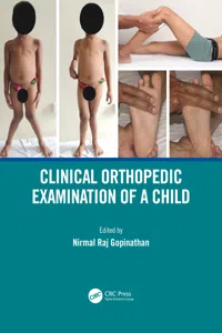 Clinical Orthopedic Examination of a Child_cover