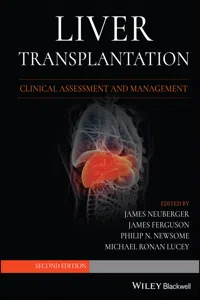 Liver Transplantation_cover