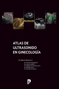 Atlas de ultrasonido en ginecología_cover