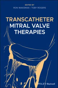 Transcatheter Mitral Valve Therapies_cover
