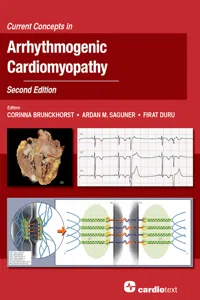 Current Concepts in Arrhythmogenic Cardiomyopathy, Second Edition_cover