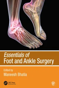 Essentials of Foot and Ankle Surgery_cover