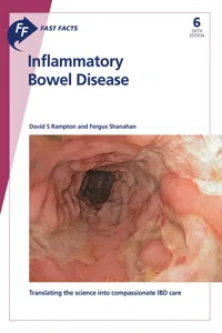 Fast Facts: Inflammatory Bowel Disease_cover