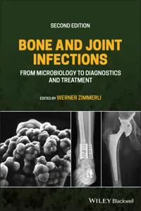 Bone and Joint Infections_cover