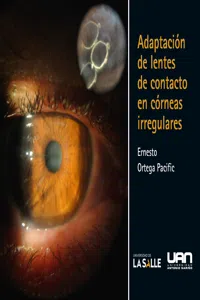 Adaptación de lentes de contacto en córneas irregulares_cover