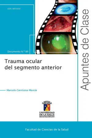 Trauma ocular del segmento anterior