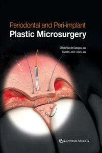 Periodontal and Peri-implant Plastic Microsurgery_cover