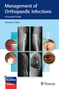 Management of Orthopaedic Infections_cover
