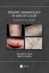 Pediatric Dermatology in Skin of Color_cover