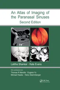 Atlas of Imaging of the Paranasal Sinuses, Second Edition_cover