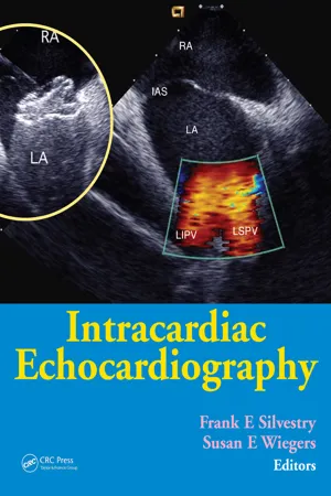 Intracardiac Echocardiography