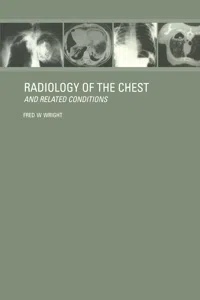 Radiology of the Chest and Related Conditions_cover