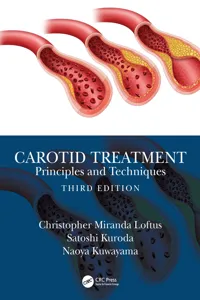Carotid Treatment: Principles and Techniques_cover