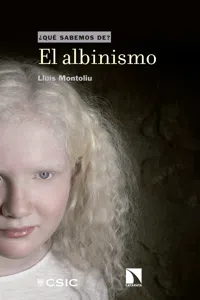 El albinismo_cover