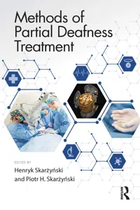 Methods of Partial Deafness Treatment_cover