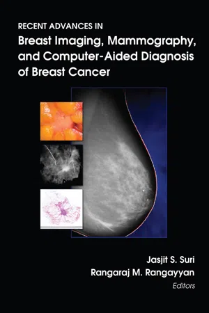 Recent Advances in Breast Imaging, Mammography, and Computer-Aided Diagnosis of Breast Cancer