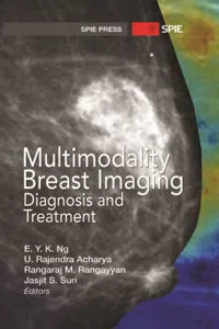 Multimodality Breast Imaging: Diagnosis and Treatment_cover