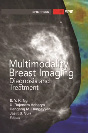 Multimodality Breast Imaging: Diagnosis and Treatment