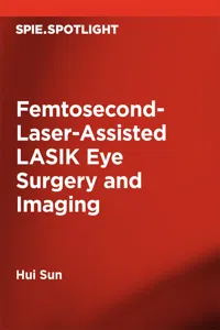 Femtosecond-Laser-Assisted LASIK Eye Surgery and Imaging_cover