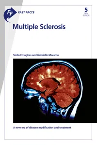 Fast Facts: Multiple Sclerosis_cover