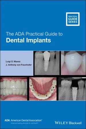 The ADA Practical Guide to Dental Implants