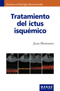 Tratamiento del ictus isquémico_cover