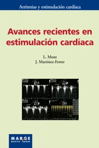 Avances recientes en estimulación cardíaca_cover