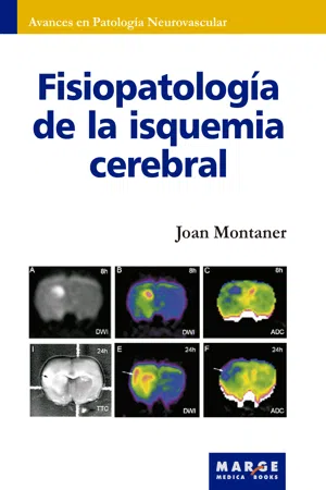 Fisiopatología de la isquemia cerebral