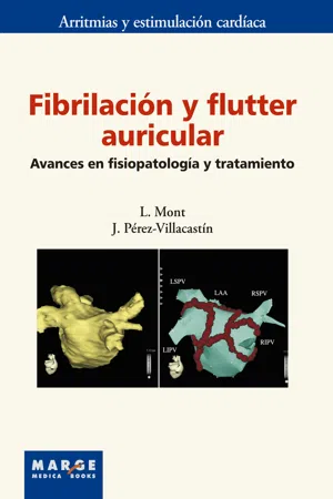 Fibrilación y flutter auricular