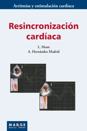 Resincronización cardíaca