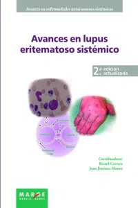 Avances en lupus eritematoso sistémico_cover