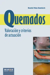 Quemados. Valoración y criterios de actuación_cover