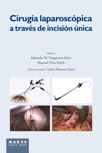 Cirugía laparoscópica a través de incisión única_cover