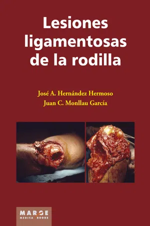 Lesiones ligamentosas de rodilla