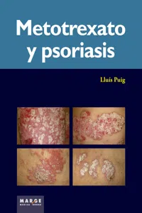 Metotrexato y psoriaris_cover