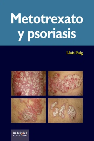 Metotrexato y psoriaris