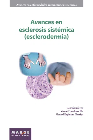 Avances en esclerosis sistémica (esclerodermia)