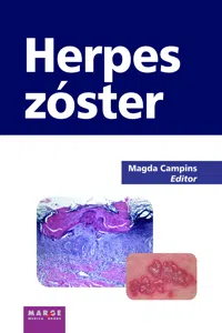 Herpes zóster_cover