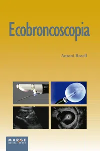 Ecobroncoscopia_cover