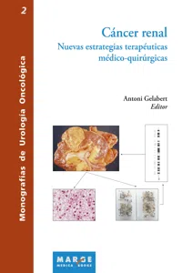 Cáncer renal. Nuevas estrategias terapeuticas medico-quirurgicas_cover