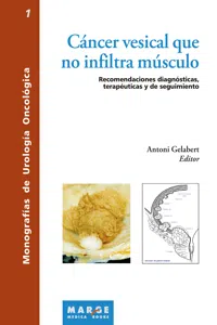 Cáncer vesical que no infiltra músculo_cover