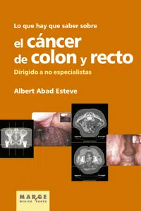 Lo que hay que saber sobre el cáncer de colon y recto_cover