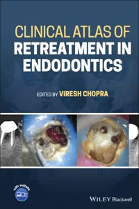 Clinical Atlas of Retreatment in Endodontics_cover